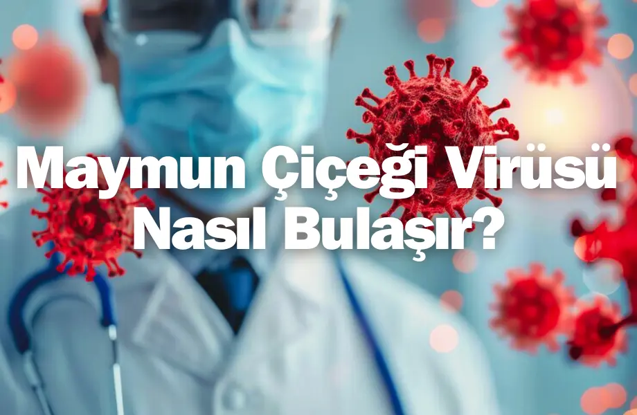 maymun çiçeği virüsü nasıl bulaşır, maymun çiçeği hastalığı nasıl bulaşır, maymun çiçeği virüsü belirtileri, maymun çiçeği hastalığı belirtileri
