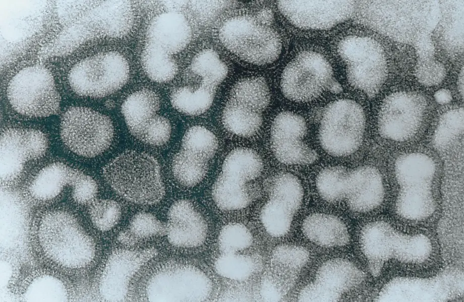 transmisyon elektron mikroskobu, viral enfeksiyon görüntüsü