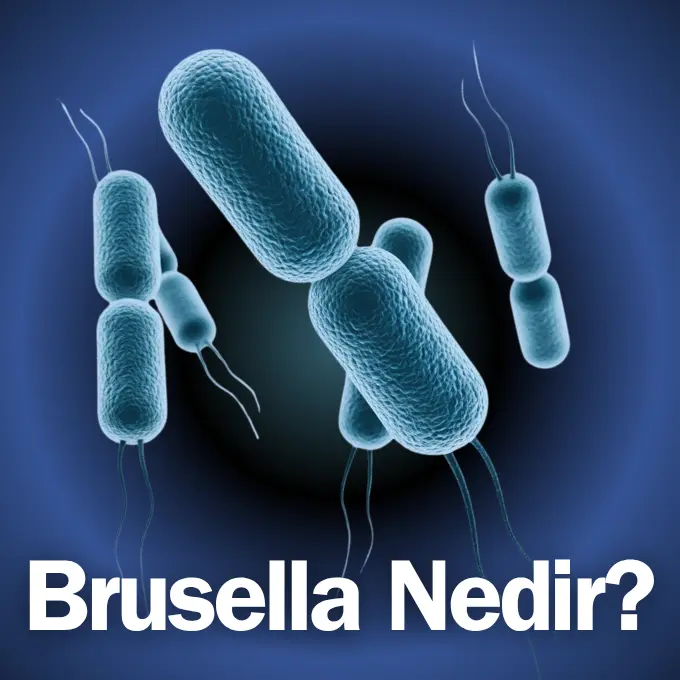 brusella nedir, brusella hastalığı nedir, brusella belirtileri, brusella nasıl bulaşır, brusella tedavisi, brusella hastalığına ne iyi gelir