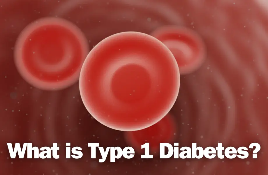 type 1 diabetes, diabetes and type 1, type 1 diabetes symptoms, type 1 diabetes symptoms and signs, type 1 vs type 2 diabetes, difference between type 1 and type 2 diabetes, type 1 diabetes treatment, treatment of type 1 diabetes, what is type 1 diabetes, is type 1 diabetes genetic, what causes type 1 diabetes, what's the difference between type 1 and type 2 diabetes, can type 1 diabetes be cured, when do you get type 1 diabetes, which is worse type 1 or type 2 diabetes, can you get type 1 diabetes as an adult, how do you get type 1 diabetes, what causes of diabetes type 1