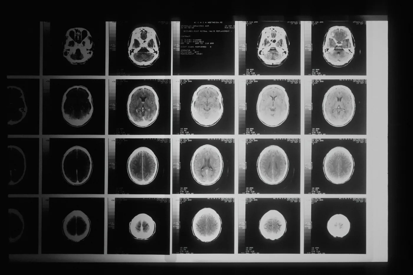 Diagnostic imaging and laboratory workflow for a brain tumour test evaluation.