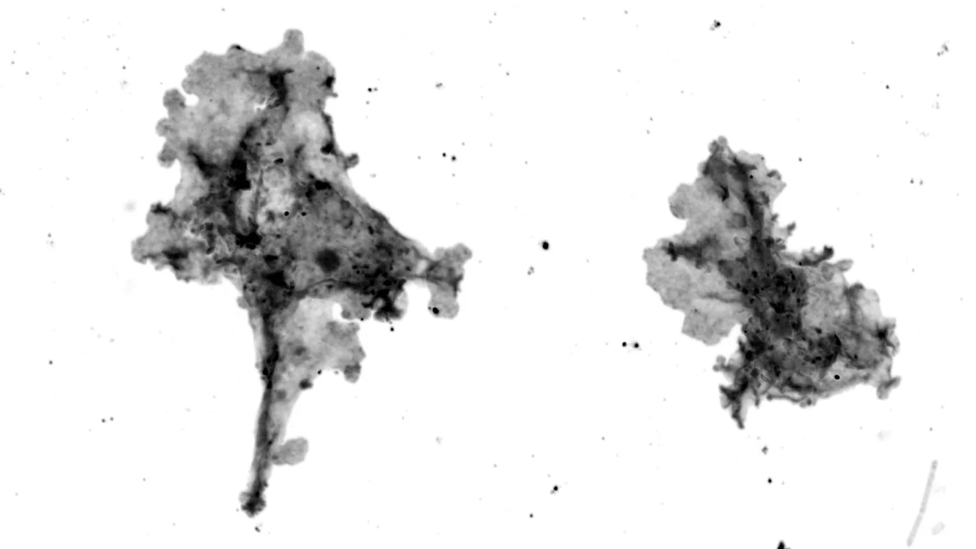 Microscopy view showing the newly discovered fire amoeba setting thermal tolerance records.