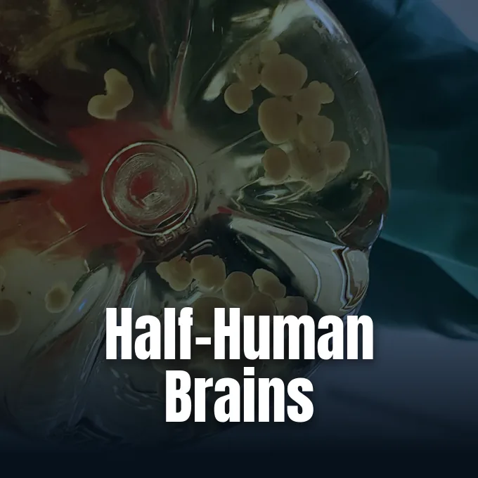Microscopic laboratory visualization of human brain organoid tissue transplanted into a mouse model from the Stanford University study published in Nature.