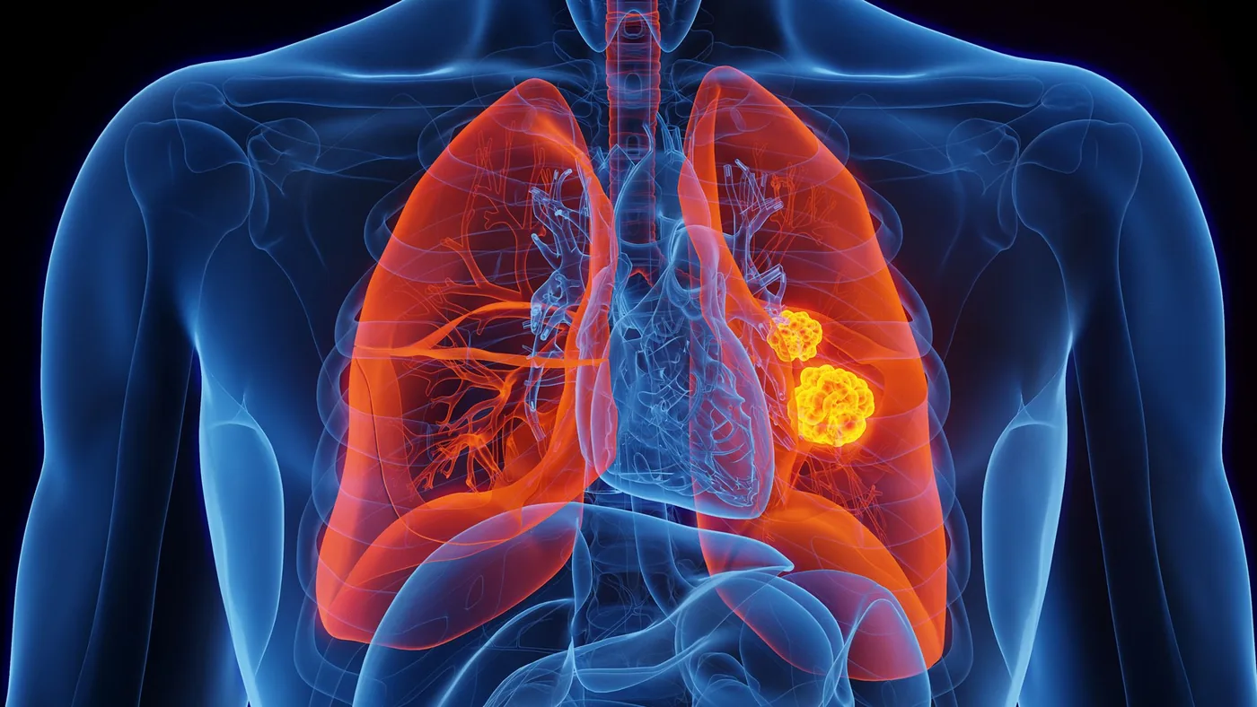 Microscopic cellular imaging of lung tissue relating to rare genetic mutation research.