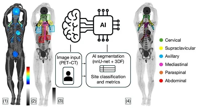 Brown fat activation identified on patient PET and CT scans using artificial intelligence