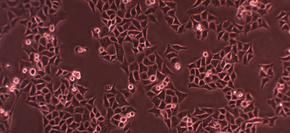 Microscopic culture with HeLa cells explained in cellular biology research