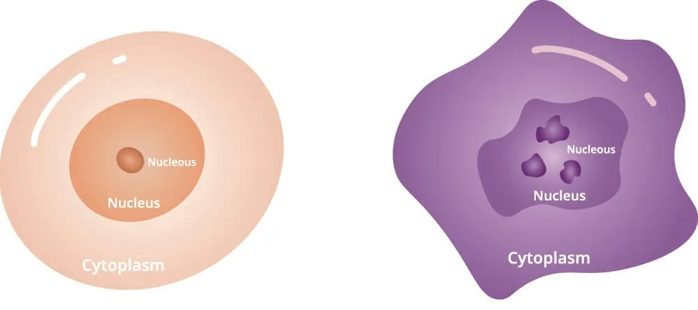 Comparison of normal cell morphology versus cancer cell morphology