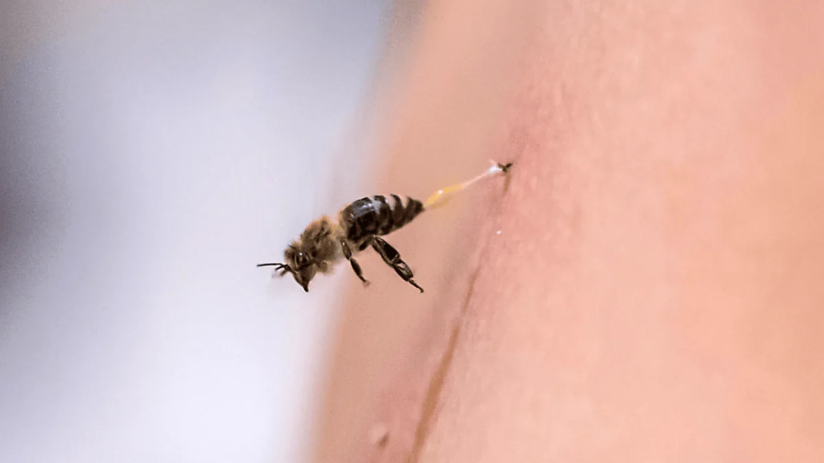 Illustration of a honey bee delivering a sting to skin tissue.