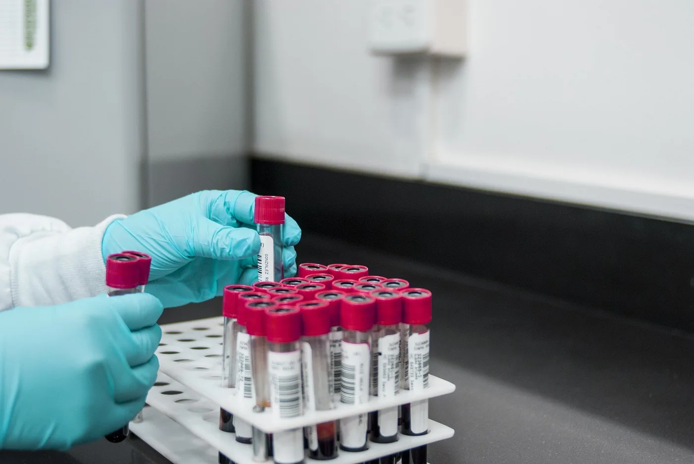 Small Cell Lung Cancer Burden Tracked Through Liquid Biopsy — Medical Xpress image
