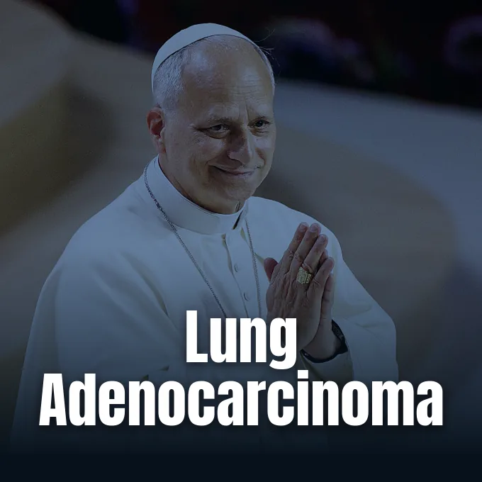 Pope Leo XIV smiling with hands clasped together in white papal cassock.