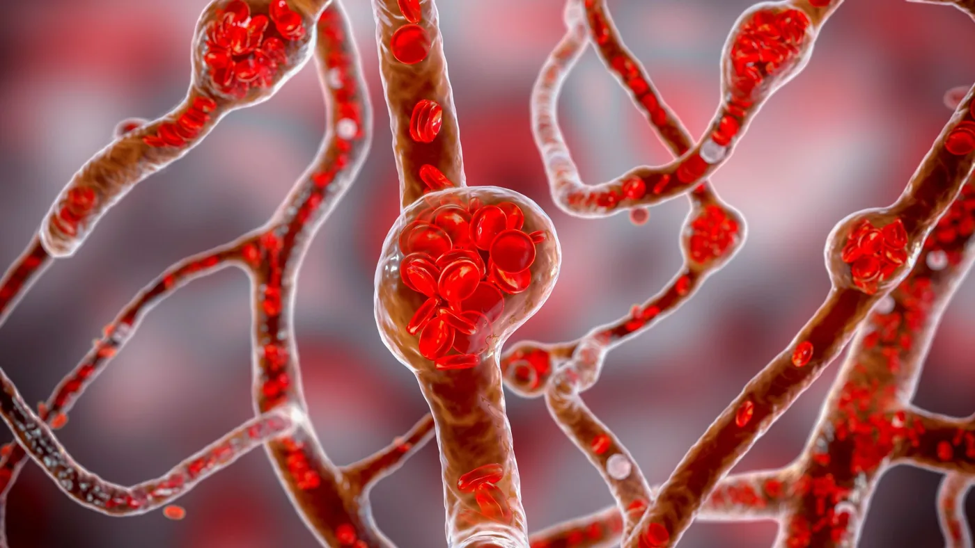 A scientific illustration representing neurogenic hypertension circuits and brain signaling pathways.