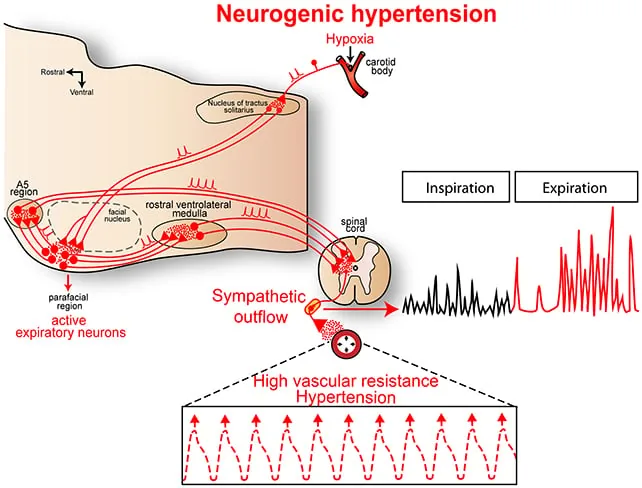 A medical diagram illustrating neural pathways between brainstem neurons and blood pressure regulation.