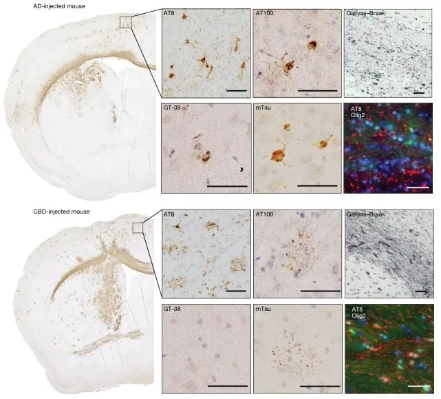 Histological sections showing the spread and prion-like transmission of human tau pathology across mouse brain tissues.