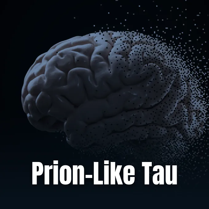 Brain illustration accompanying ScienceAlert reporting on the prion-like transmission of human tau proteins.