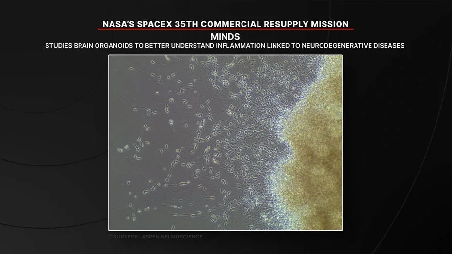Microscopic views of lab-grown human brain models tested during orbital investigations.