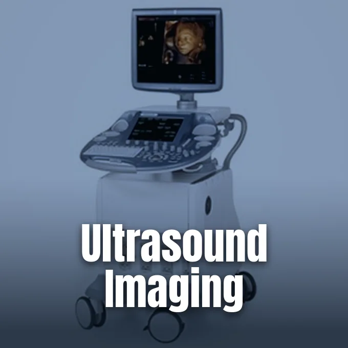 A medical ultrasound diagnostic machine with a display monitor showing a 3D fetal scan